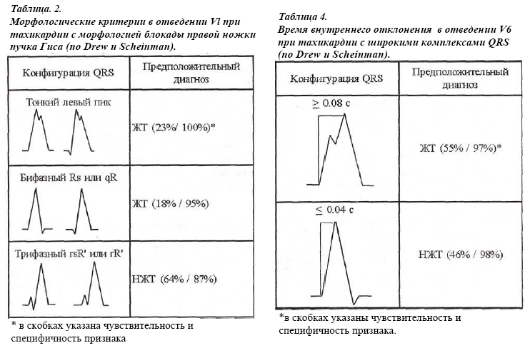 qrs