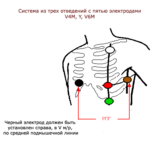 система отведений для записи реопневмограммы